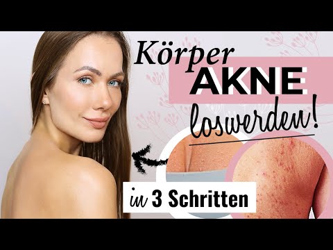 🙆‍♀️ Pickel am Rücken, Brust &amp; Arm loswerden! - So habe ich es geschafft!