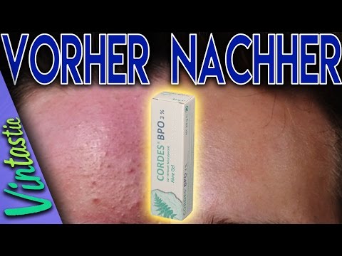 AKNE-FREI SEIT 4 JAHREN ● BPO Methode ● Pickel loswerden/Akne bekämpfen