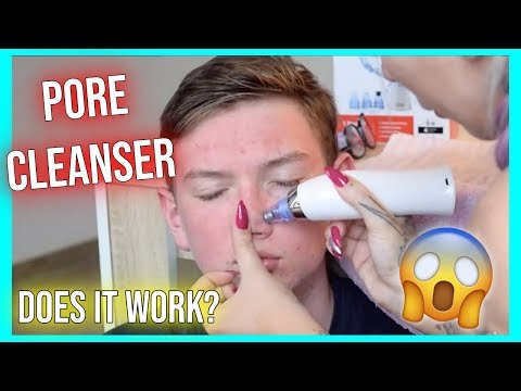 PORE CLEANSER im Test 💆🏼‍♂️😱🙈JENNY KÖNIG