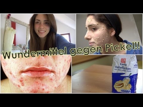 ❃ Mein Wundermittel gegen Pickel !! ❃